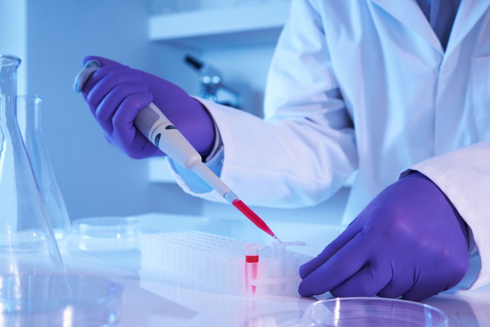 asins analīzes, lai diagnosticētu hronisku bakteriālu prostatītu